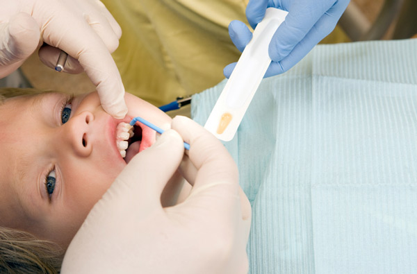Young boy receiving fluoride treatment at dentist